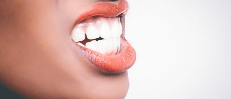 Wat zijn de nadelen van tanden bleken?
